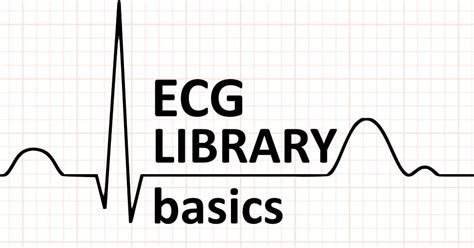 ecg for dummies|EKG basics • LITFL • LITFL ECG Library .